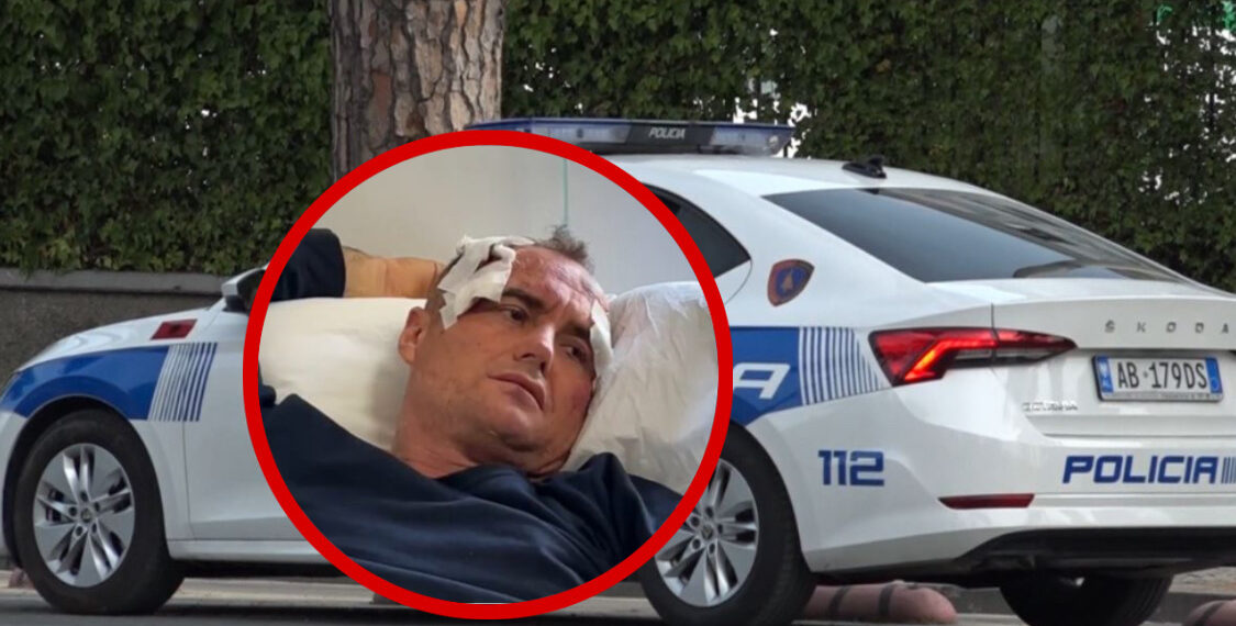 Altin Mecaj i komentoi të motrës në facebook, polici Fredi Lamaj bën për spital babë e bir në Fier.